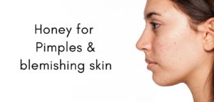 Remove pimples with honey