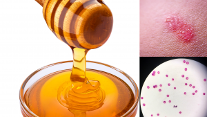 honey for yeast infection
